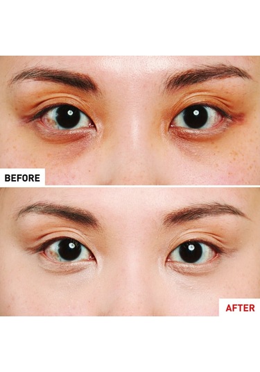 Erborian Super Bb Concealer Dore Kapatıcı 10 Ml