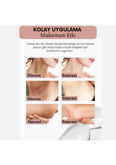 Cilt Beyazlatıcı Doğal Bitkisel Pirinç Sabunu 100 Gr