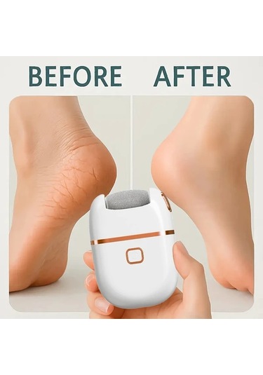 Primepickings Feıyba Bs Şarj Edilebilir 3 Taşlama Başlıklı 2 Hızlı Ayak El Taşlama Makinesi Çatlak Topuklar Ve Tırnak Bakımı İçin