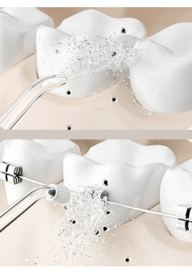 Lichen Ortodontik Temizlik Özel Ev Tipi Su İpi, Su İpi Su