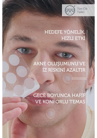 The Purest Solutions Microneedle Teknolojili Akne Bant, Akne Karşıtı Yama, Mikroiğneli Bant, 9'lu