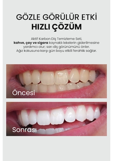 Luis Bien Aktif Karbon Diş Temizleme Tozu 50 G + Diş Macunu 75 ML + Bambu Diş Fırçası