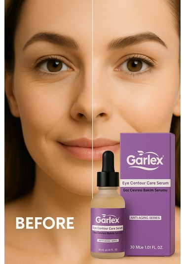 Garlex Göz Çevresi Bakım Serumu 30 ML