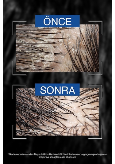 Bioblas Thermal Expert Men Kepek ve Saç Dökülmesine Karşı Şampuan 360 Ml