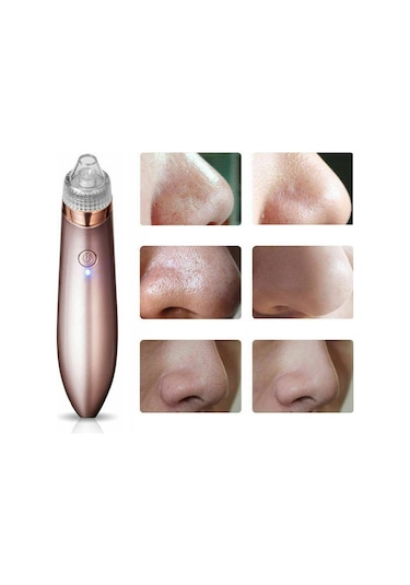 Vakumlu Akne ve Siyah Nokta Temizleme Cihazı