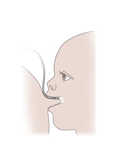 Eday Eds Emzirme Destek Sistemi Yedek Hortum (20 Adet)