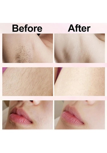 Elektrikli Tıraş Makinesi Kadın Tıraş Makinesi Ağrısız Kadın Bıyık Epilatör Pink Pembe