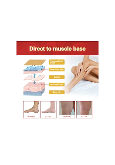 Vkemall Jaysuing Varis Rahatlatıcı Bant - Bacak Ağrısı Ve Şişlik İçin 12'li Paket