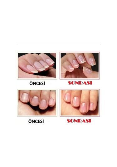 Tırnak Törpüleme Aleti Cam Malzeme Parlatma Manikür Pedikür 5 Adet