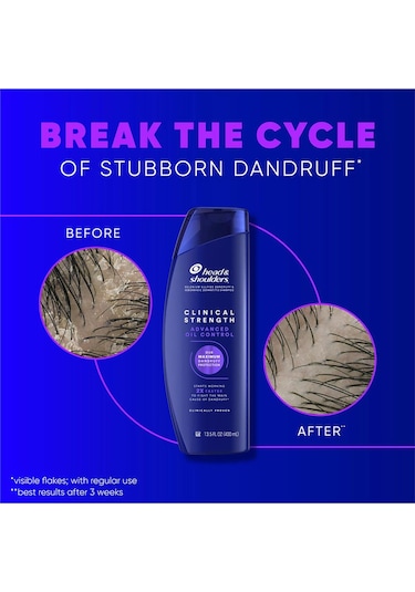 Head & Shoulders Clinical Strength Advanced Oil Control Kepek Karşıtı Şampuan 400ml Tüm Saçlar