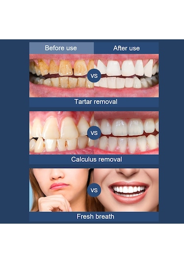 Ultrasonik Elektrikli Ölçekleyici Ev Diş Temizleyici Taşınabilir Ölçekleme Aleti Siyah