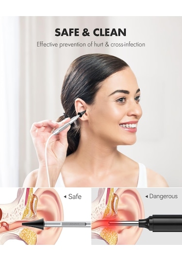 Anykit Usb Otoskop 3.9mm Ultra Net Kulak Kamerası - İphone/android/pc
