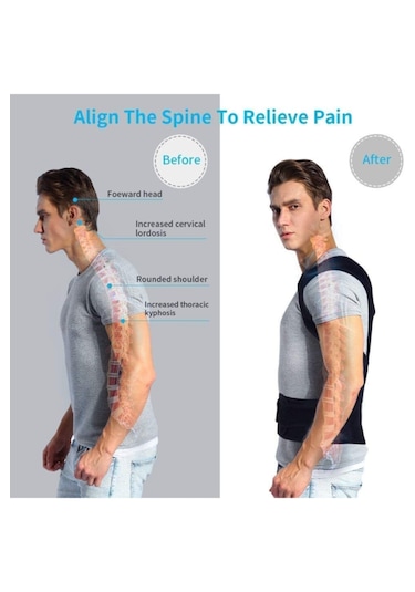 Duruş Düzeltici Dik Duruş Korsesi Sırt Bel Omuz Korsesi Skolyoz