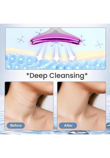 Wondernest Yüz Yüz Siyah Microcurrent Masaj Liken Kaldırma Ems Yüz Jp Siyah