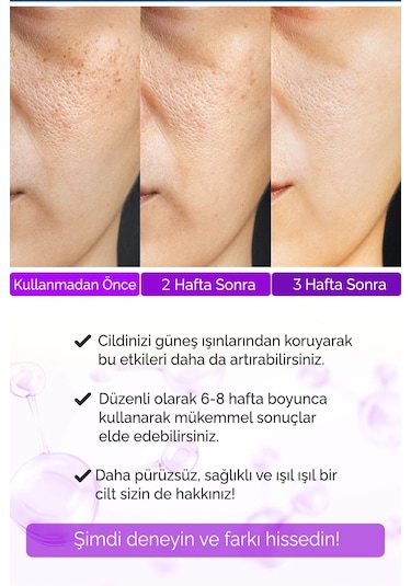 Devida Yaşlanma ve Kırışıklık Karşıtı Göz Çevresi Retinol Serum 30 ML