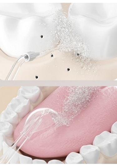 Lichen Ortodontik Temizlik Özel Ev Tipi Su İpi, Su İpi Su