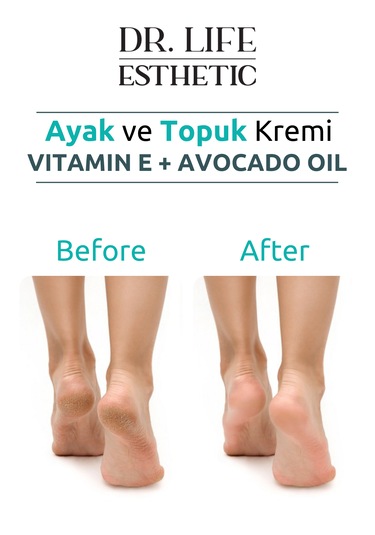 Dr. Life Esthetic Ayak ve Topuk Bakım Kremi 100 ML