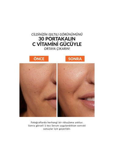 Anew Radiance Vitamin C Serum Ve Maximising Tonik Paketi