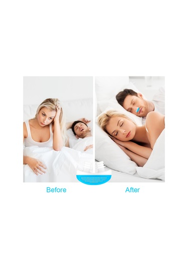 Vkemall Anti Horlama Burun Temizleyici Horlama Çözümü Mini Horlama Durdurucu Horlama Aza Beyaz