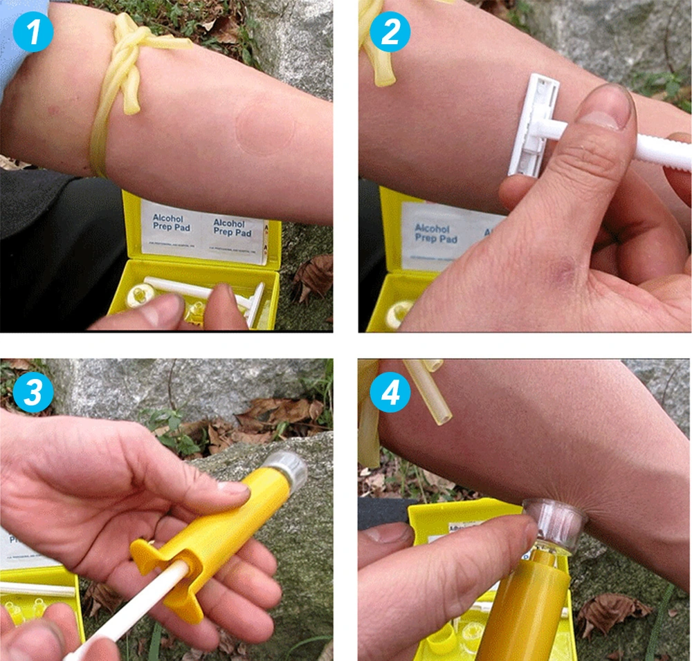 Dofolink Acil Durum Venom Çıkarıcı Seti - Dışarıda Yılan Arı Isırıkları İçin Vakumlu Tıkanıklama Aleti Sarı Sarı