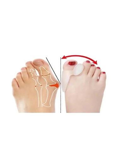 Ozclife Silikon Makaralı Ayak Baş Parmak Kemik Bunyon Koruyucu