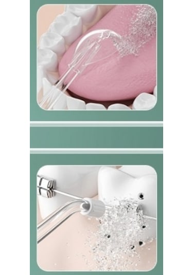 Lichen Ev Tipi Ağız Duşu, Taş Temizleyici, Diş Yıkama Makinesi,