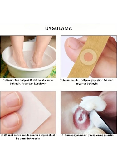 Onomo Nasır Bandı Nasır Yakısı 6 Adet