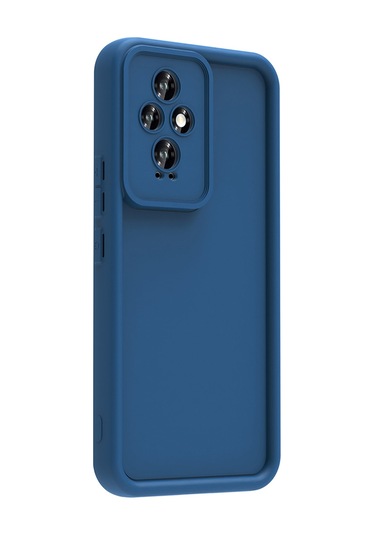 Zore Honor 200 Kılıf Kamera Korumalı Msra Ananas Kapak - Siyah Siyah