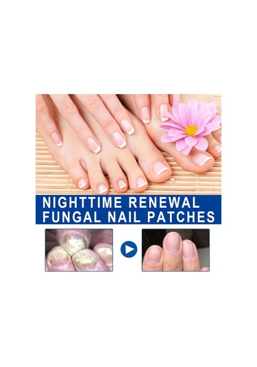 Yifomall 32 Adet Onyxomykoz Ve İçine Giren Tırnak Tamir Bandı - Su Geçirmez, Nefes Alır, Tırnak Büyüme Açısını Düzeltir Bakım Bandı