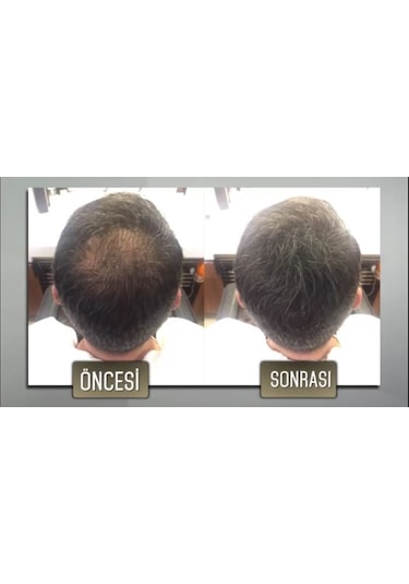 Jaja Saç Dolgunlaştırıcı Topic Dark Brown 50 Gr