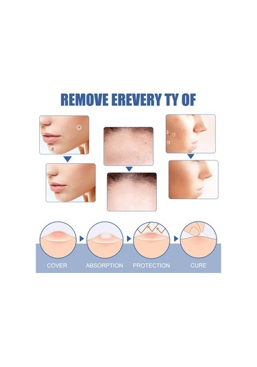 Vkemall Eelhoe Doğal İçerikli Siğil Yapışkanları 144 Adet, Ağrısız Cilt Temizliği, Her Cilt Tipi İçin Uygun, Su Geçirmez Ve Nefes Alabilir.