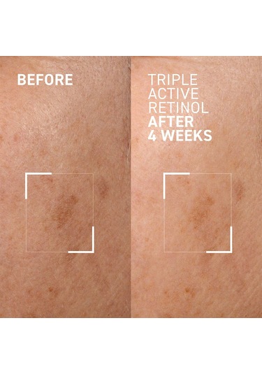 Dr. Brandt Triple Active Retinol 30 Ml