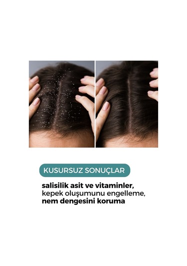 Zento Kepek Karşıtı Saç Bakım Toniği 150 ML