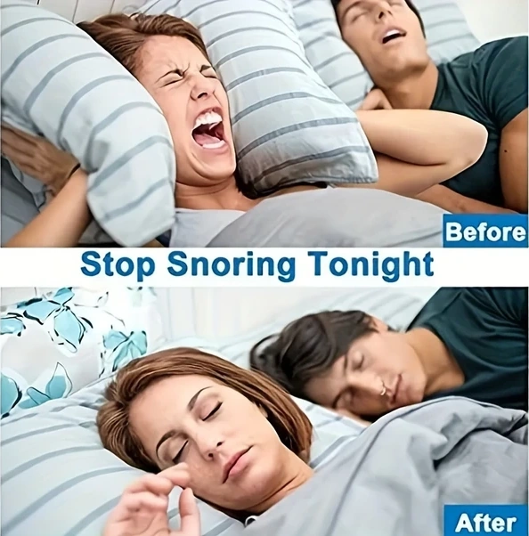 Chenkestoreone 30 Adet Mini Horlama Önleyici Cihaz, Burun Klipsi Daha İyi Uyku