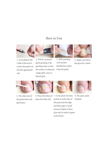 Moveevo Paronişi Düzeltme Aleti Batık Tırnaklar Ve Kıvırcık Tırnaklar Düzeltme Aleti Seti 24 Yama