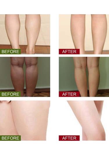 Qingmipy "20'lik Detoks Ayak Banyosu Poşeti - Zencefil, Safran Ve Pelin İle Kan Dolaşımını Artırır Ve Ödemi Azaltır"