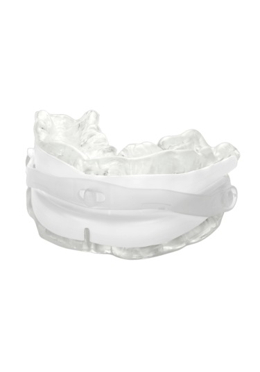 Somnofit-b, Mandibular Alt Çene İlerletme Aparatı