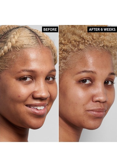 The Inkey List Niacinamide Serum 30 ML