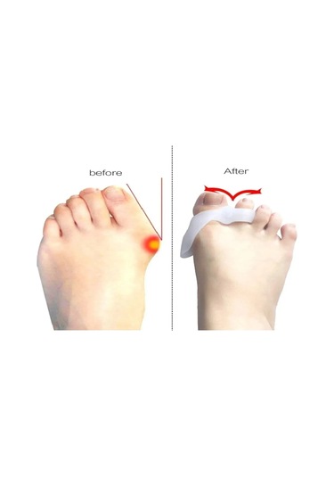 Ozclife Iki Parmaklı Makaralı Bunyon %100 Silikon - Türk Malı