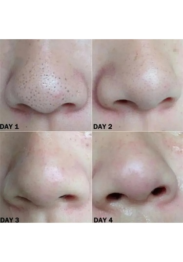 Youtek Bamboo Kömürlü Siyah Nokta Temizleme Burun Bandı - 10 Adet