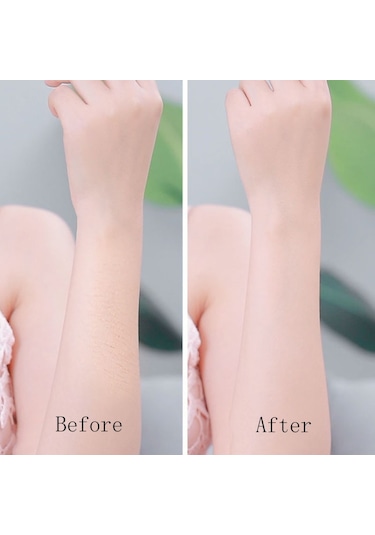 Sones Usb Şarjlı Yüz Çektirici Yüz Tüy Alma Cihazı Lüks Altın