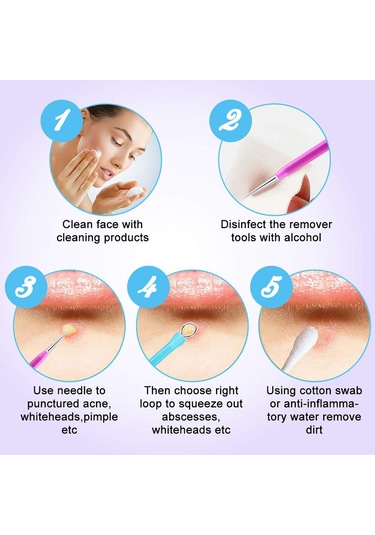 Hangfox 10'lu Paslanmaz Çelik Akne Ve Siyah Nokta Kaldırma Aracı Seti, Mavi-mor Renkli, Siyah Depolama Çantasıyla