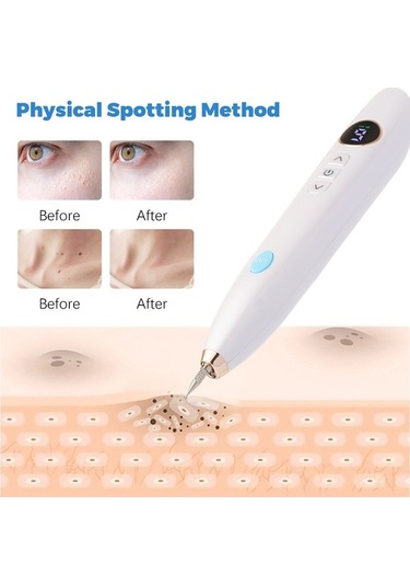 Carrier- 9 Vitesli Lazer Köstebek Kalemi Takılabilir Güzellik,hızlı Relaks Masaj Cihazları,renpho Masaj 10020530 Beyaz