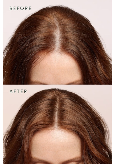 Scalpify Saç Toniği Dökülme Karşıtı & Hacim Destekleyici Biberiye + Spirulina + Vitamin Kompleksi