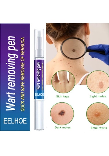 Cilt Etiketi Sökücü Benlere Karşı Tıbbi Ağrısız Hızlı Kaldırma Genital Siğil Akne Leke Tedavisi Papillomlar Düz Siğil Güzellik Sağlık