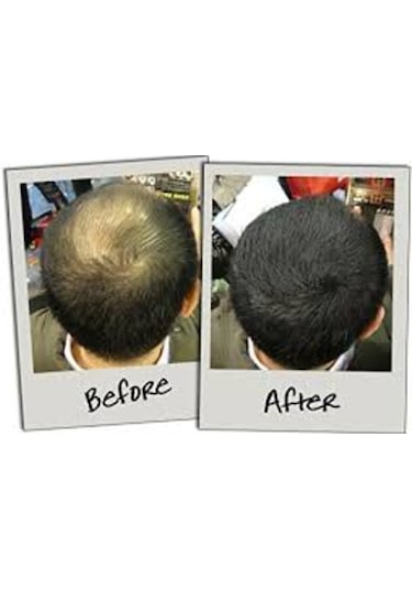 Sevich 100 Gr Siyah Orta Koyu Kahve Saç Fiberi Keratin Saç Tozu