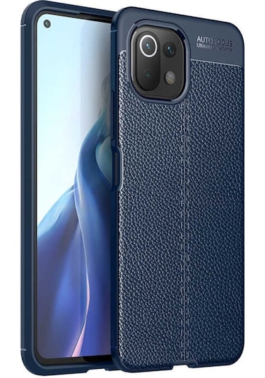 Xiaomi Mi 11 Lite Kılıf Zore Niss Deri Desenli Silikon Kılıf