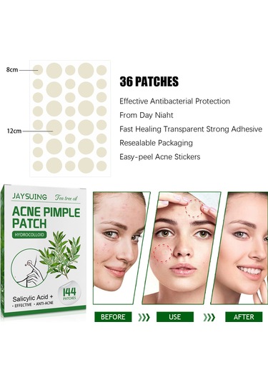 Youtek 144 Adet Sivilce Yama Bandı - Hidrokolloid, Çay Ağacı Yağlı, Beyaz Nokta Ve İltihaplı Sivilceler İçin