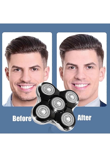 Yedek Tıraş Başlığı, Remington Balder Pro Head Shaver Xr7000, Xr1500, Xr1501 Kel Erkekler İçin Elektrikli Tıraş Makinesine Uygundur