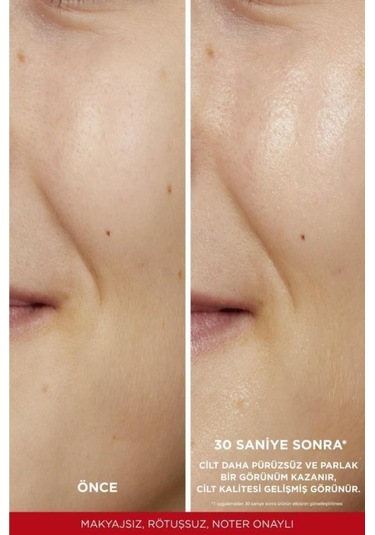 Revitalift %5 Saf Glikolik Asit Peeling Etkili Tonik & Nem Terapisi Normalden Karmaya Ciltler pktglklknmtrps-9271